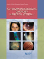 G-autoimmunologiczne-choroby-narzadu-wzroku_4537_150x190