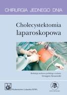 G-chirurgia-jednego-dnia-cholecystektomia-laparoskopowa_9764_150x190