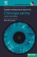 G-chirurgia-zacmy-seria-techniki-chirurgiczne-w-okulistyce_4942_150x190
