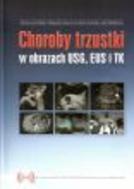 G-choroby-trzustki-w-obrazach-usg-eus-i-tk_12722_150x190