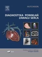 G-diagnostyka-powiklan-zawalu-serca_7530_150x190