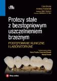 Protezy stałe z bezstopniowym uszczelnieniem brzeżnym Postępowanie kliniczne i laboratoryjne