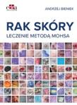 Rak skóry Leczenie metodą Mohsa