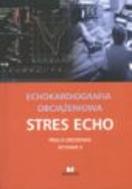 G-echokardiografia-obciazeniowa-stres-echo_1835_150x190
