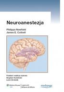 G-neuroanestezja_12498_150x190