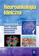G-neuroonkologia-kliniczna_8443_150x190