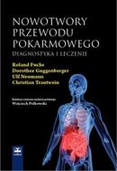 G-nowotwory-przewodu-pokarmowego-diagnostyka-i-leczenie_10418_150x190
