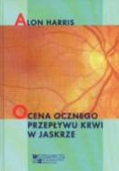 G-ocena-ocznego-przeplywu-krwi-w-jaskrze_348_150x190