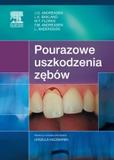 Pourazowe uszkodzenia zębów