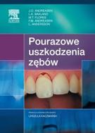 G-pourazowe-uszkodzenia-zebow_2202_150x190