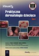 G-praktyczna-dermatologia-dziecieca-tom-1_12671_150x190