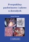 Przepukliny pachwinowe i udowe u dorosłych