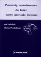G-przerzuty-nowotworowe-do-kosci-nowe-kierunki-leczenia_1308_150x190