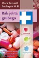 G-rak-jelita-grubego-nowe-metody-badania-nowe-sposoby-leczenia-nowe-mozliwosci_1586_150x190