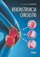 G-rekonstrukcja-chrzastki-ratujemy-kolano-nie-wymieniamy-b-iext214613532_29966_150x190