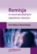 G-remisja-w-reumatoidalnym-zapaleniu-stawow_7754_150x190