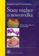 G-stany-naglace-u-noworodka_8265_150x190