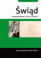 G-swiad-patomechanizm-klinika-leczenie_7317_150x190