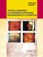 G-terapia-laserowa-w-chorobach-siatkowki-niezwiazanych-z-cukrzyca_5928_150x190