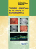 Terapia laserowa w retinopatii cukrzycowej
