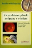 G-zwyrodnienie-plamki-zwiazane-z-wiekiem_8246_150x190