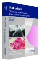 Rak piersi – wczesne wykrywanie przy użyciu mammografii