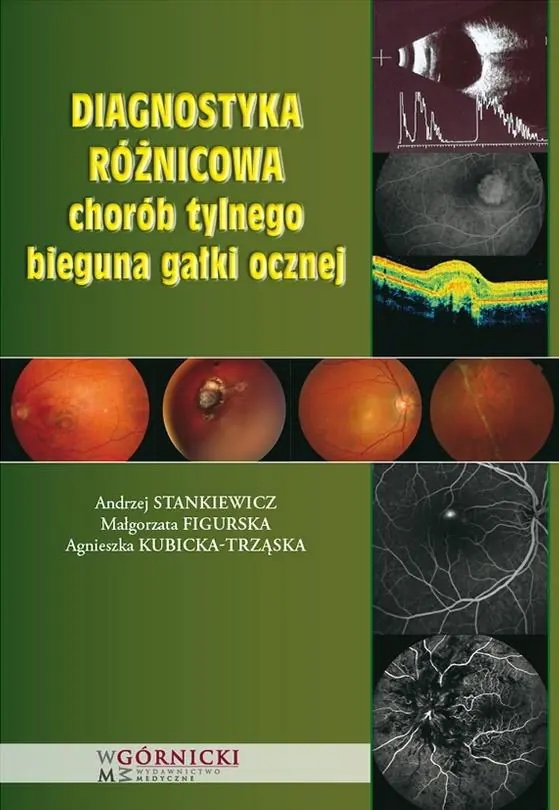 Diagnostyka różnicowa chorób tylnego bieguna gałki ocznej