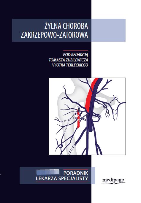 Żylna choroba zakrzepowo-zatorowa