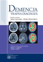 Demencja Trafna diagnoza
