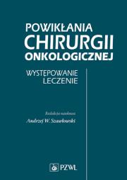 Powikłania chirurgii onkologicznej Występowanie Leczenie