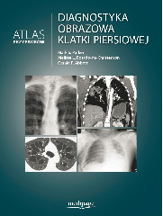 Diagnostyka obrazowa klatki piersiowej Atlas przypadków klinicznych