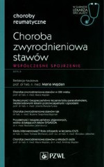 Choroba zwyrodnieniowa stawów Współczesne spojrzenie