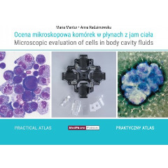Ocena mikroskopowa komórek w płynach z jam ciała