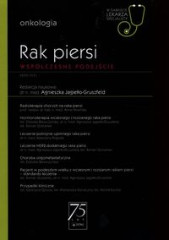 Rak piersi Współczesne podejście
