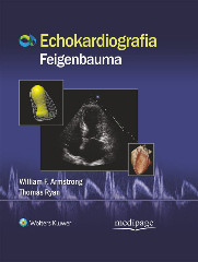Echokardiografia Feigenbauma