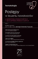 Postępy w leczeniu nowotworów limfoproliferacyjnych i mieloproliferacyjnych W gabinecie lekarza specjalisty