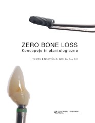 ZERO BONE LOSS Koncepcje implantologiczne