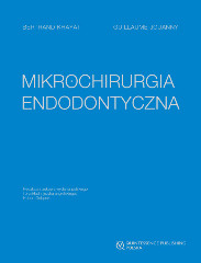 Mikrochirurgia Endodontyczna