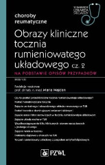 Obrazy kliniczne tocznia rumieniowatego układowego cz 2 Na podstawie opisów przypadków