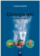 Chirurgia ręki Ciekawe przypadki