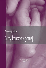Guzy kończyny górnej