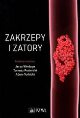 Zakrzepy i zatory