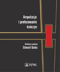 Amputacje i protezowanie kończyn