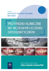 Przypadki kliniczne we wczesnym leczeniu ortodontycznym Atlas kiedy jak i dlaczego leczyć