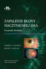 Zapalenie błony naczyniowej oka