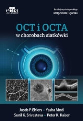 OCT i OCTA w chorobach siatkówki