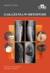 Zakażenia w ortopedii Chen