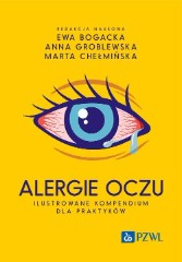Alergie oczu Ilustrowane kompendium dla praktyków