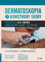 Dermatoskopia i nowotwory skóry. Podręcznik dla łowców nowotworów skóry i czerniaka