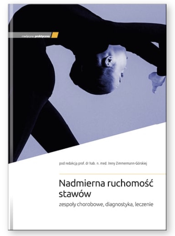 Nadmierna ruchomość stawów